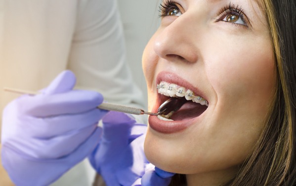 What Are Orthodontics