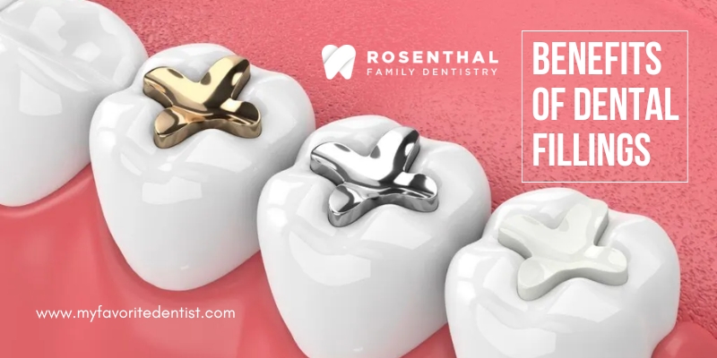 Dental Fillings - Rosenthal Dentistry