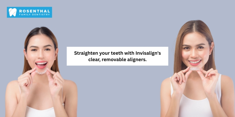Invisalign