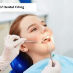 Types of Dental Fillings