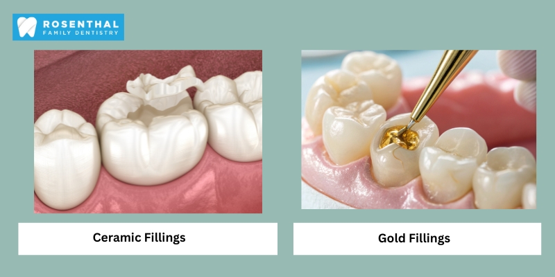 Types of Dental Fillings