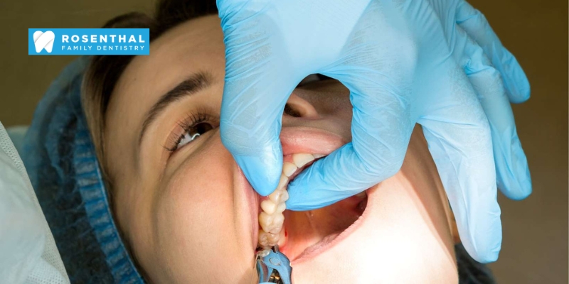 Wisdom Tooth Removal Surgery