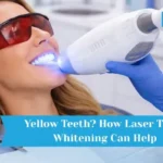 Dentist performing laser teeth whitening procedure to remove yellow stains from teeth