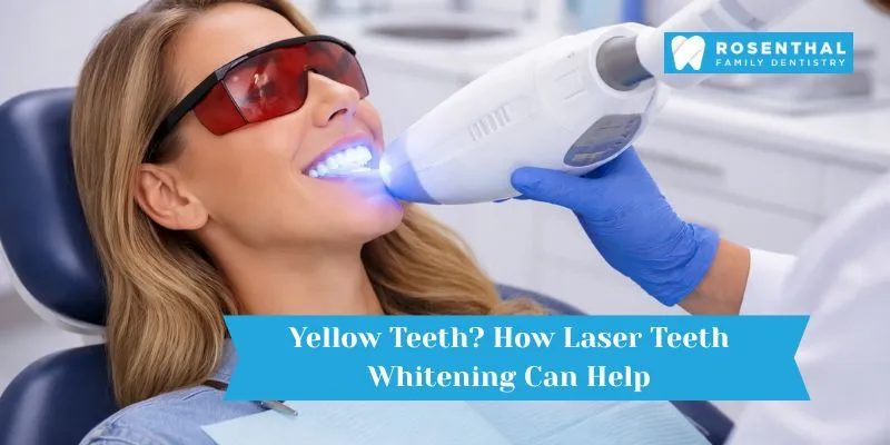 Dentist performing laser teeth whitening procedure to remove yellow stains from teeth