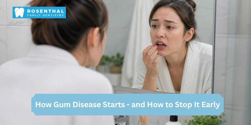 Person checking gums in mirror showing early signs of gum disease like bleeding and swelling while brushing teeth