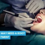 7 Signs You May Need a Root Canal Treatment