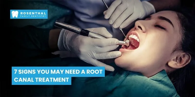7 Signs You May Need a Root Canal Treatment