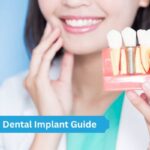 First-Time Dental Implant Guide