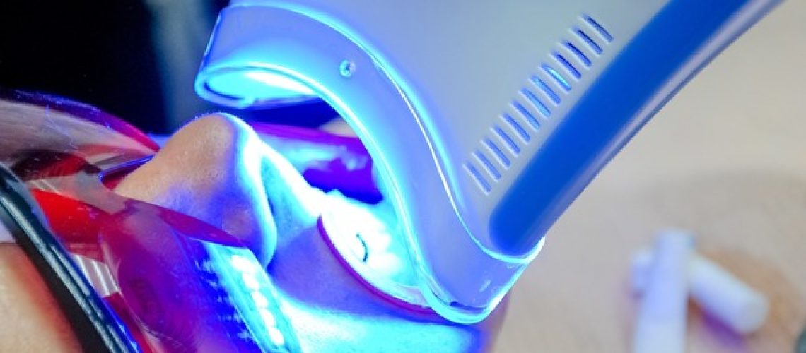 Teeth Whitening - Rosenthal Family Dentistry